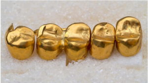 Gold Teeth