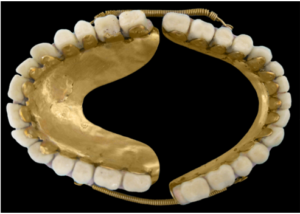mouth-dental-gold