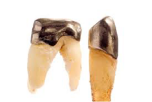 Dental Gold Root