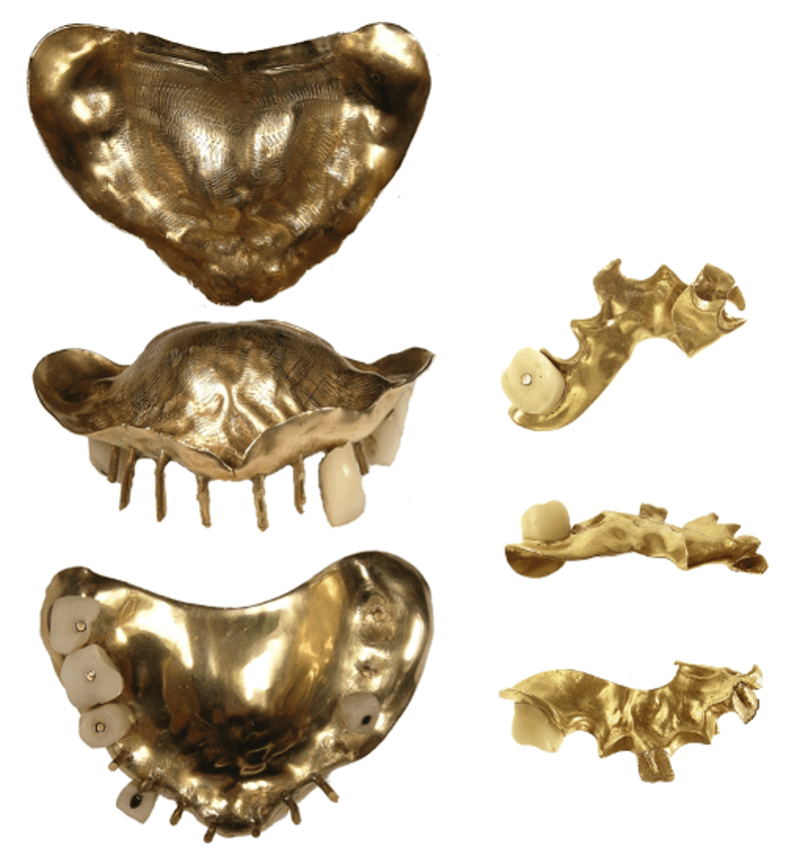 Dental Gold: Everything You Need to Know